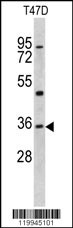 KLF6 Antibody