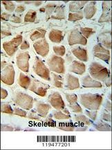 Calponin-3 Antibody