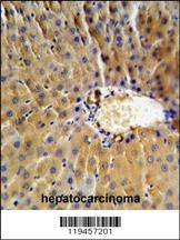 SERPINB3 Antibody