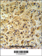 GNS Antibody