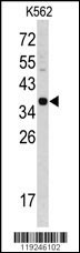 CTSE Antibody