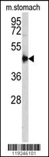 CTSE Antibody