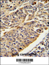 CTSE Antibody