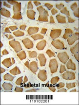 NPEPPS Antibody