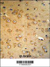 VHL Antibody