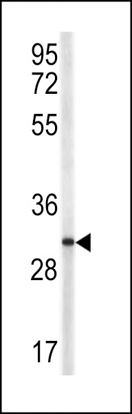CD40LG Antibody