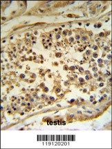 HFE Antibody