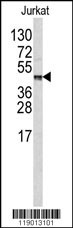 CPB2 Antibody