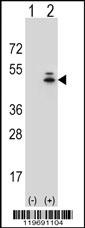 ACTG1 Antibody