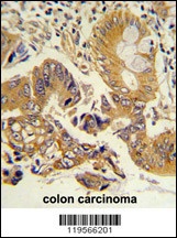 CLNS1A Antibody