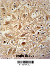 ARPC1A Antibody