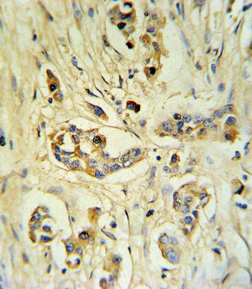 FIBB Antibody