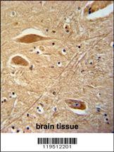 FIBB Antibody
