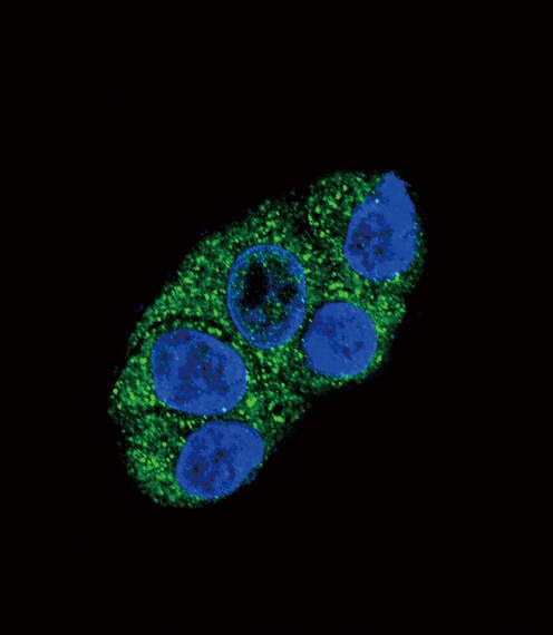 ATP7B Antibody