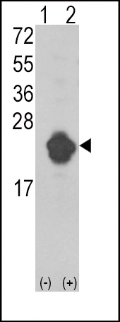 IL1RN Antibody