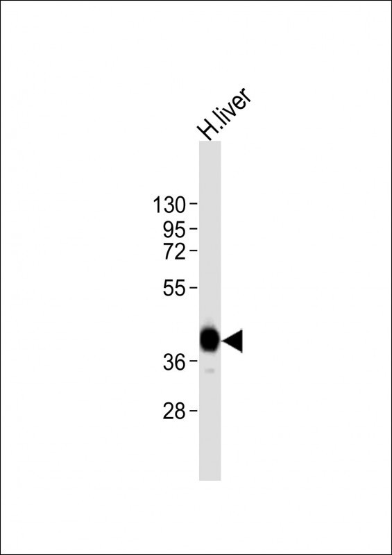 AGXT Antibody