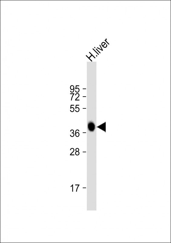 AGXT Antibody