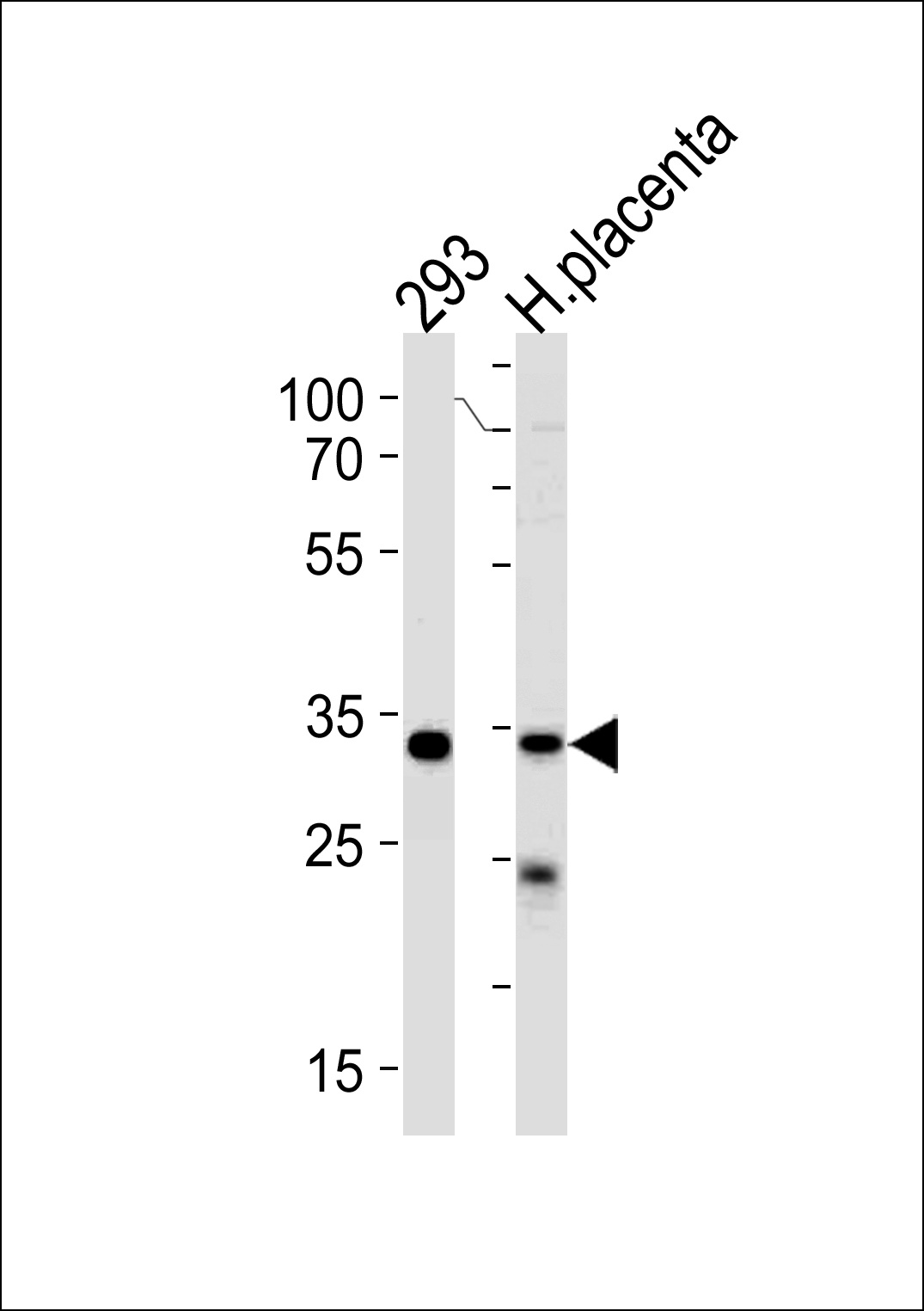 STUB1 Antibody