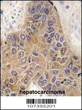 STUB1 Antibody