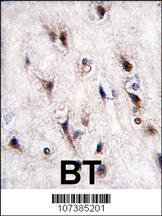 NURR1 Antibody