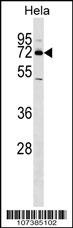 NR4A2 Antibody