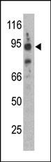 SNCAIP Antibody