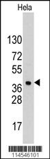 HDGF Antibody