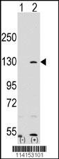 PARP1 Antibody