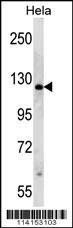PARP1 Antibody