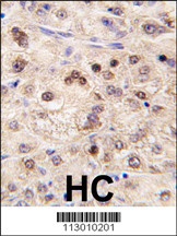 ZBTB7B Antibody