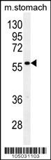 GPC3 Antibody