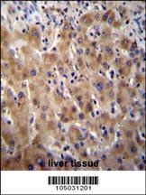 Glypican 3 Antibody