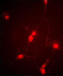 CLCN4 Antibody