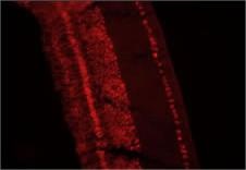 CLC4 Antibody