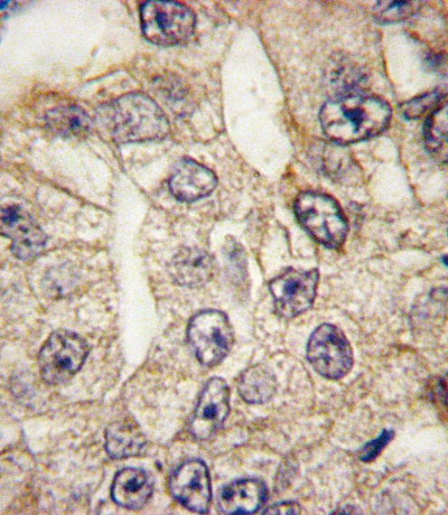 CD14 Antibody