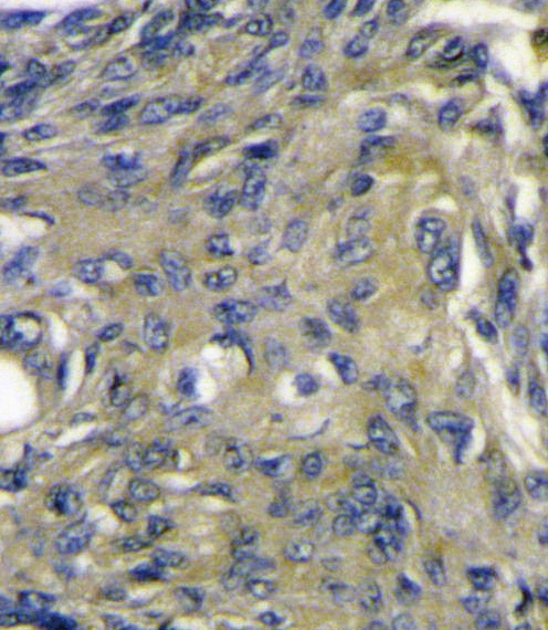 VEGFD Antibody