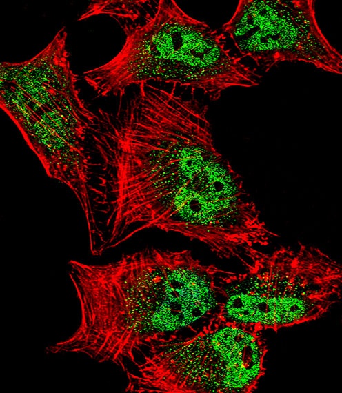 MEF2C Antibody