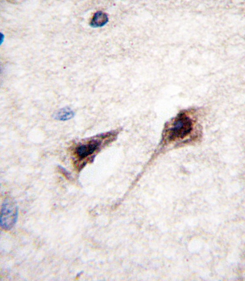 MEF2C Antibody
