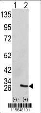 GRB2 Antibody