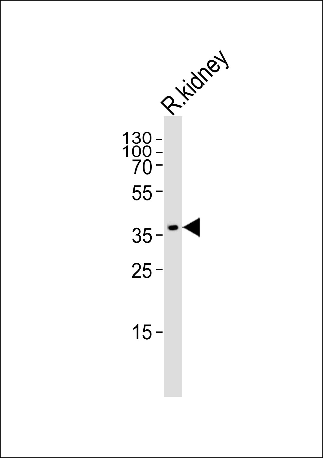 SCDGFB Antibody