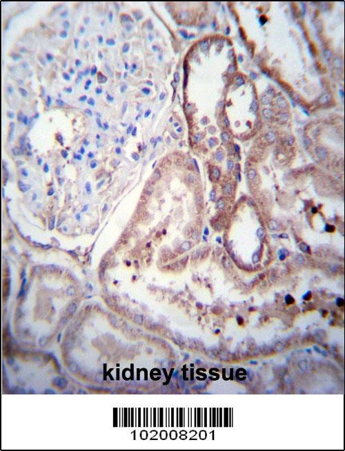 SCDGFB Antibody