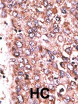 WISP3 Antibody