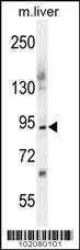 ST14 Antibody