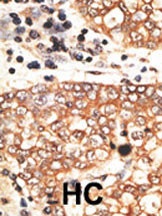 NRG2 Antibody