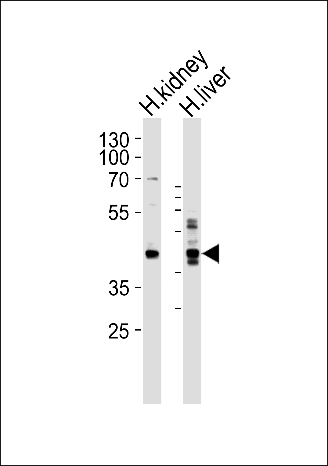 SEPT9 Antibody