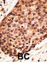 MMP16 Antibody