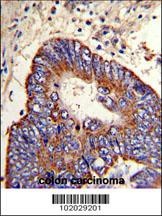 MMP15 Antibody