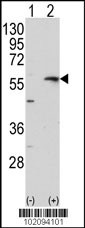 MMP13 Antibody