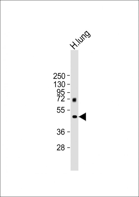 MMP12 Antibody