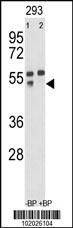 MMP12 Antibody